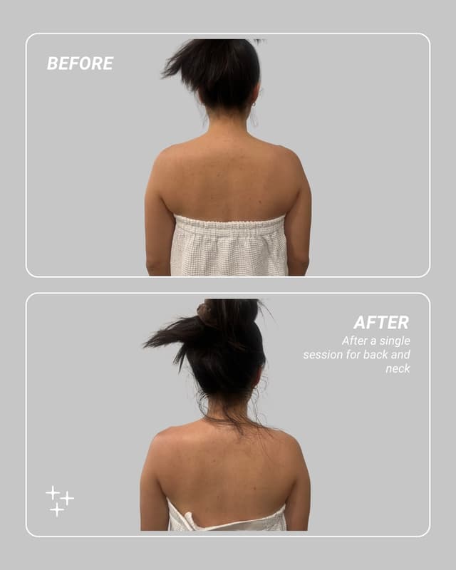 Before and after a single Bio-TENS therapy session for back and neck — shoulders visibly more open